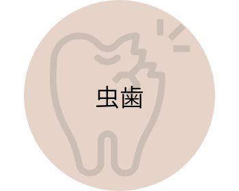 虫歯